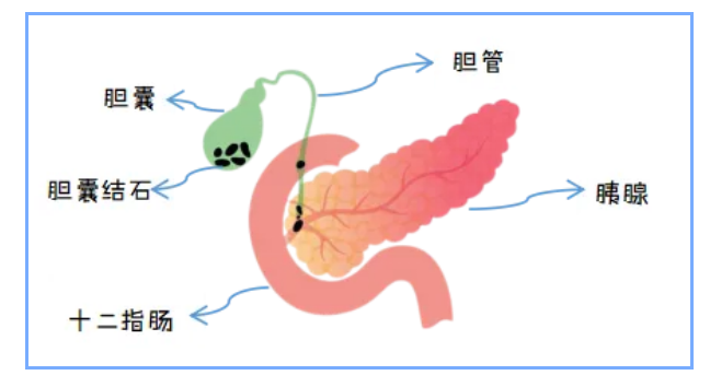 探秘MRCP——胰胆管检查无创之选1.png